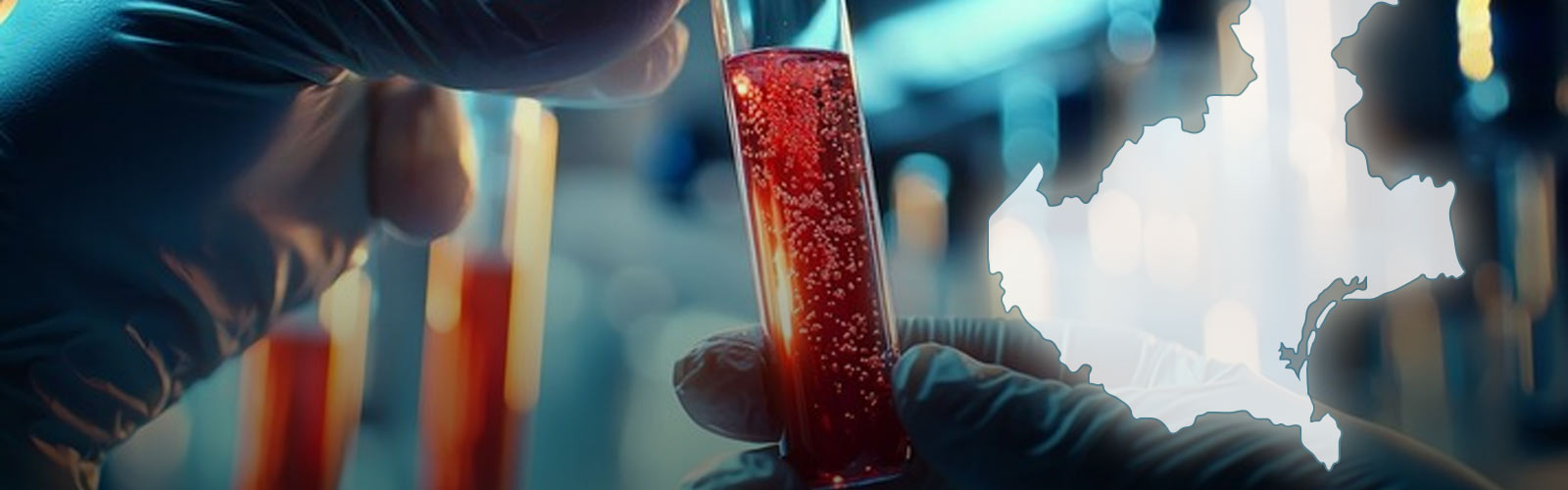 I nuovi percorsi diagnostico-terapeutici assistenziali (PDTA) della Rete Ematologica Veneta (REV)