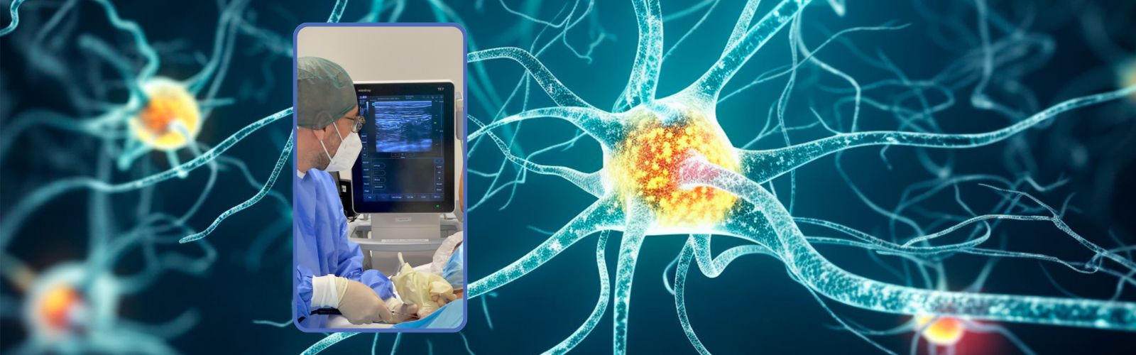 Spasticità, un ago che genera una pallina di ghiaccio blocca la contrazione muscolare