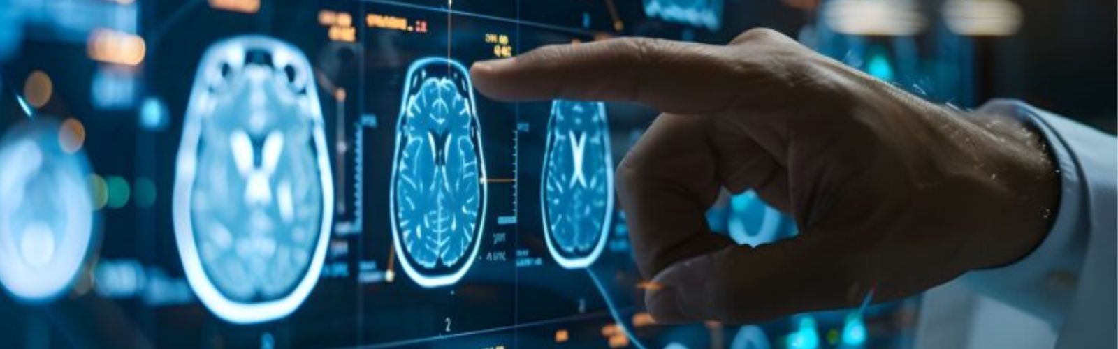 Sclerosi multipla, la corteccia cerebrale aiuta a prevedere l’evoluzione della malattia