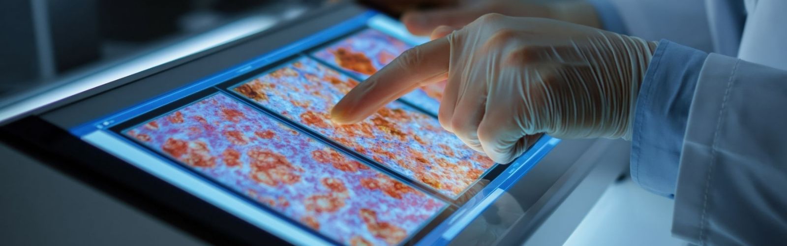Tumori, da Verona oltre 70 nuovi modelli per la ricerca oncologica internazionale