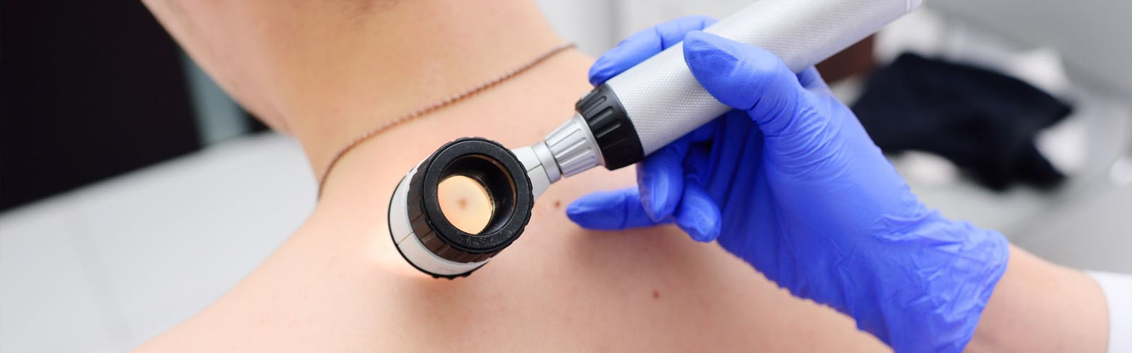 Vaccini terapeutici a mRna contro il melanoma