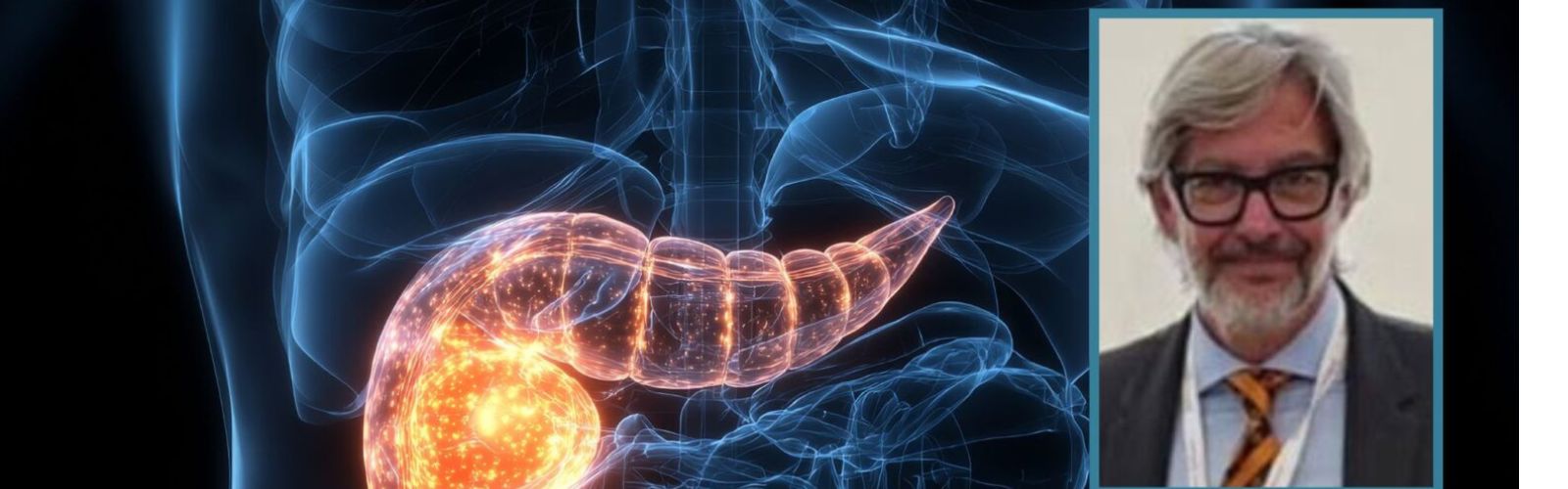 Il tumore al pancreas e le nuove armi terapeutiche